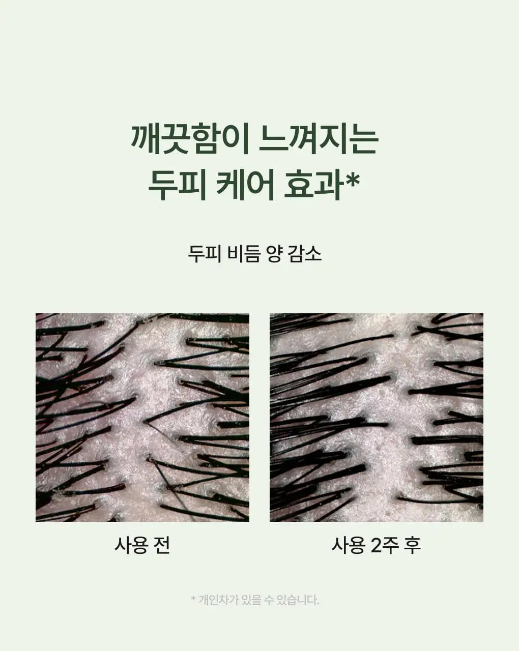 [성분천재/두피케어] 청미정 다시마 샴푸 500ml (단품/기획) 상세페이지 10